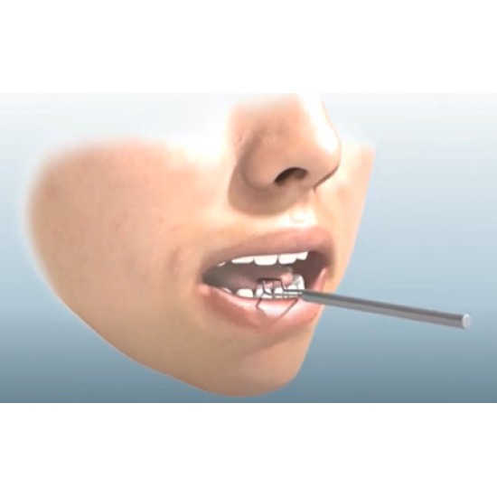 SPEECH SONDES PRO