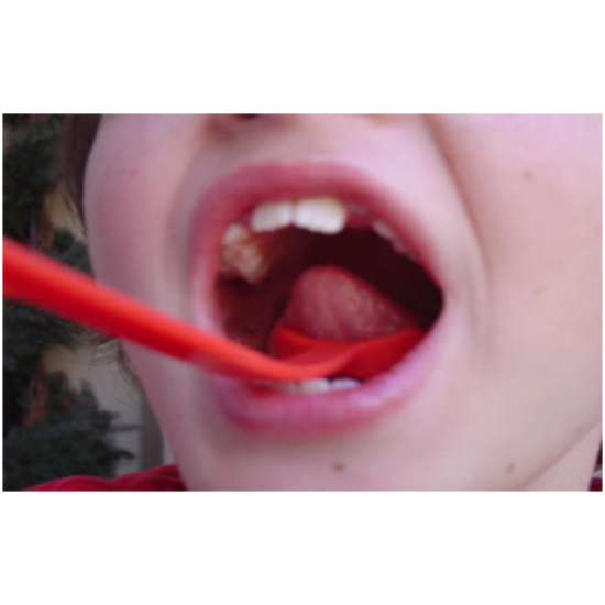 ΓΛΩΣΣΙΚΟΣ ΑΝΥΨΩΤΗΣ TONGUE LIFTER