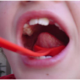 ΓΛΩΣΣΙΚΟΣ ΑΝΥΨΩΤΗΣ TONGUE LIFTER
